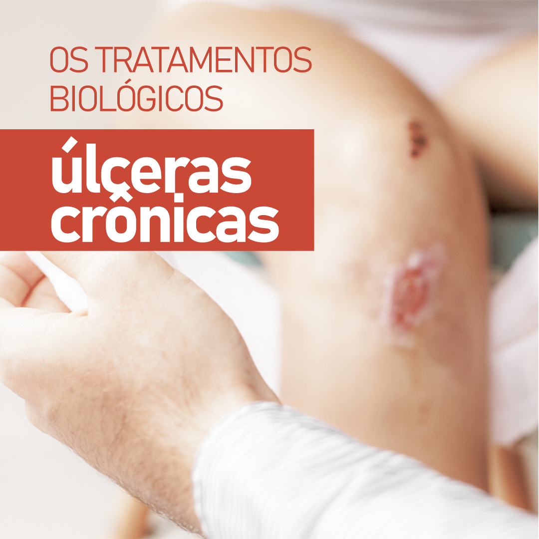 Os Tratamentos Biol Gicos Para Lceras Cr Nicas Dr Jorge Taqueda