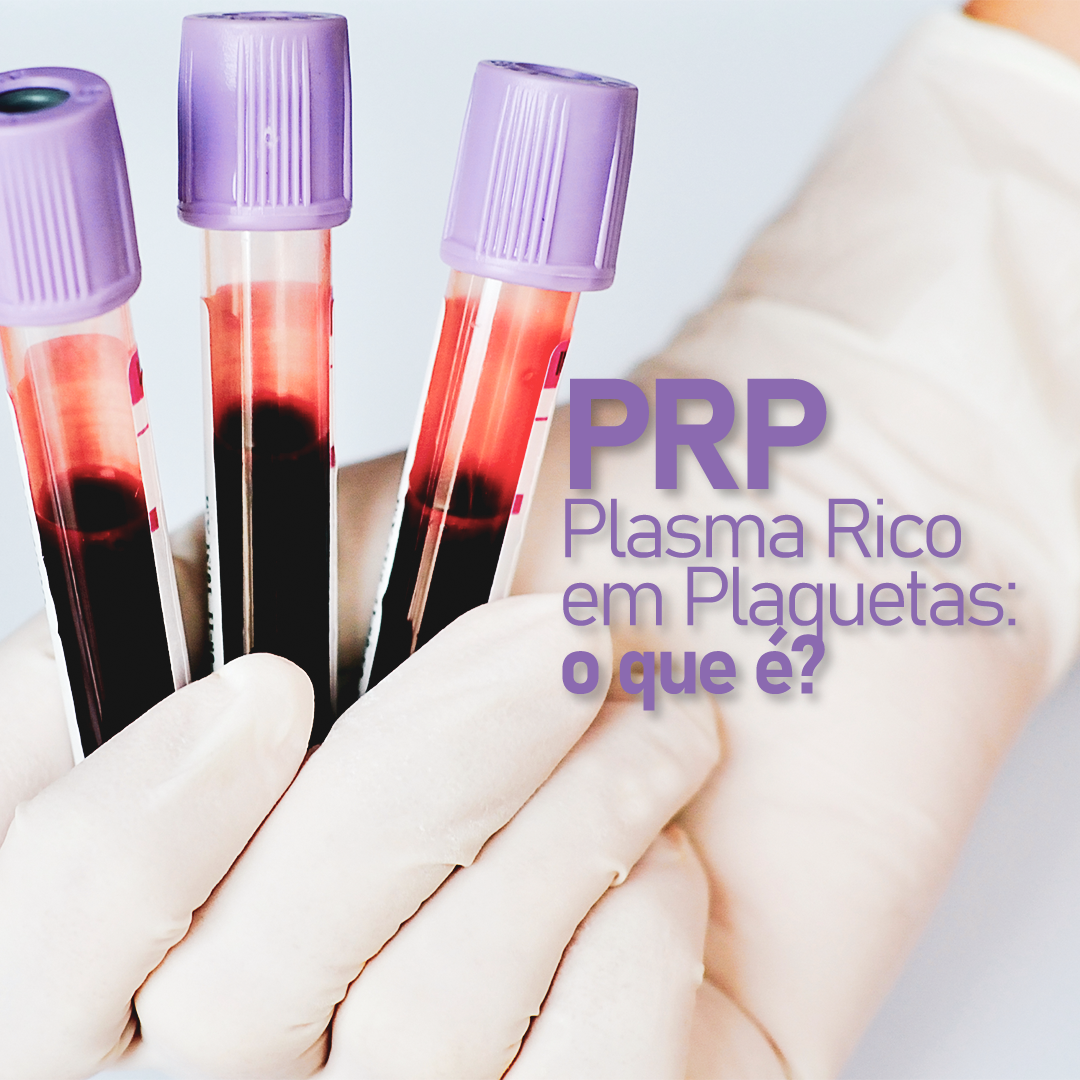 Plasma Rico Em Plaquetas O Que é Dr Jorge Taqueda