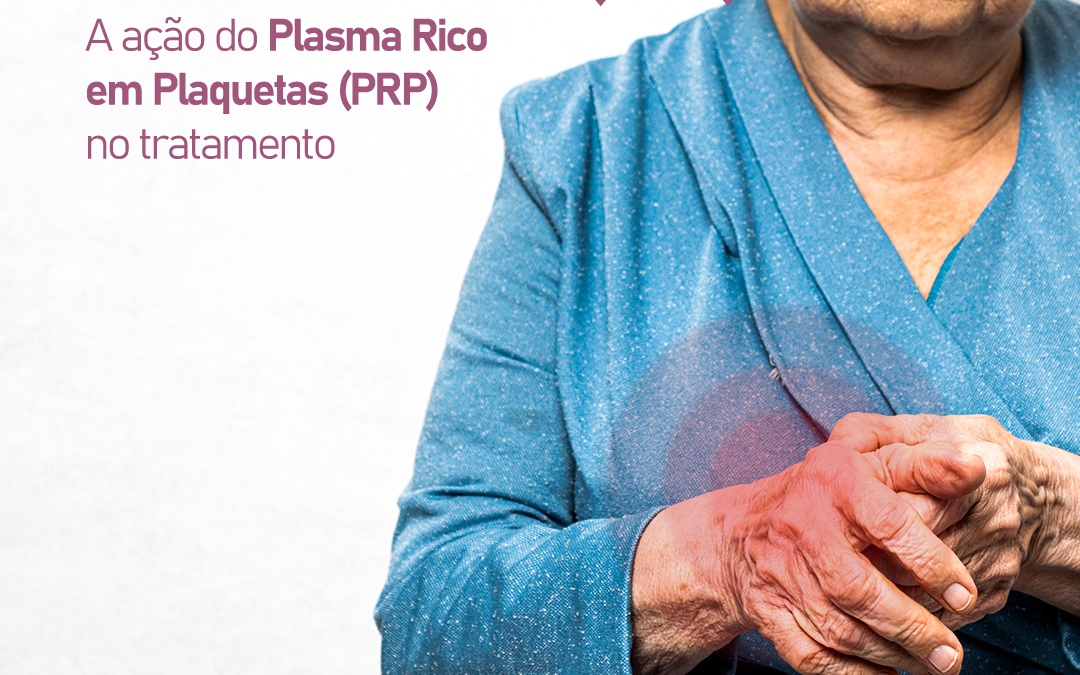 a-acao-do-plasma-rico-em-plaquetas-(prp)-no-tratamento-da-osteoartrite-(oa)