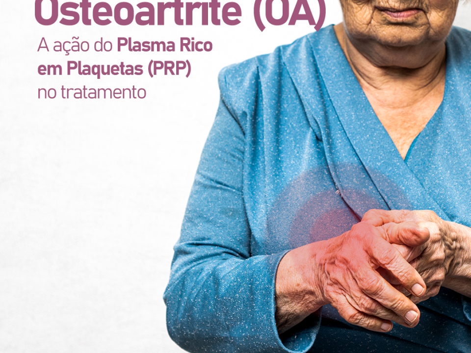 a-acao-do-plasma-rico-em-plaquetas-(prp)-no-tratamento-da-osteoartrite-(oa)