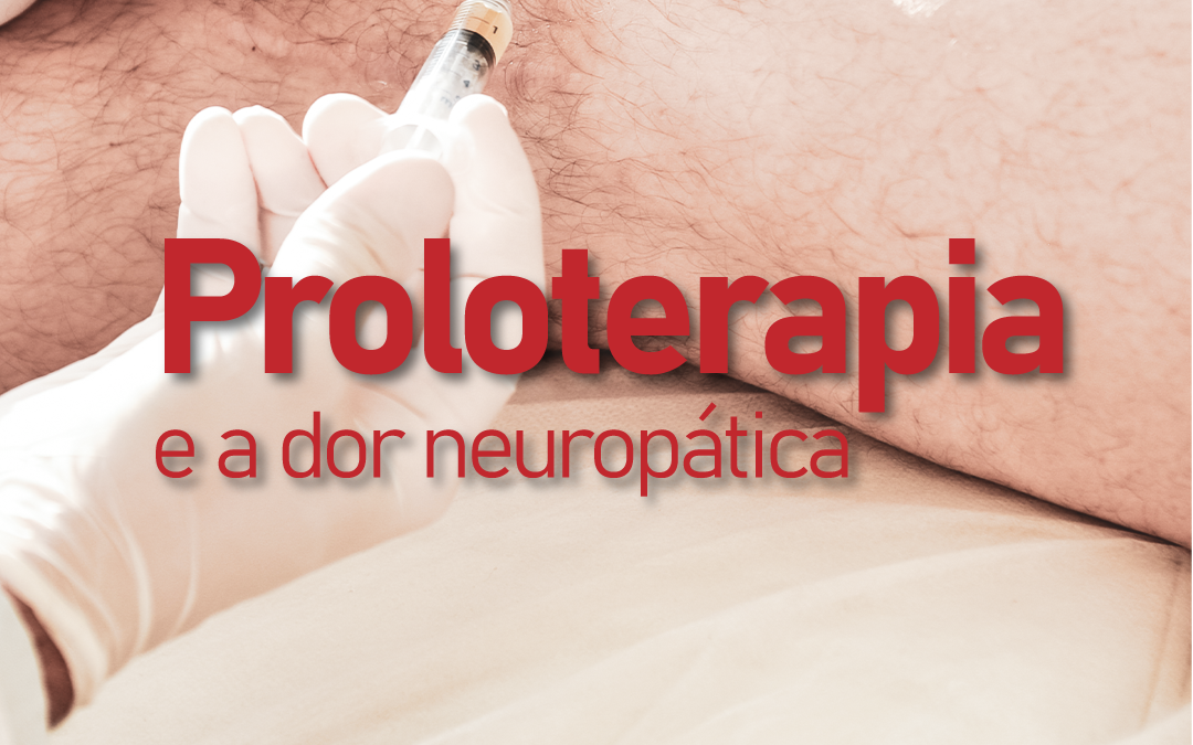 proloterapia-e-a-dor-neuropatica