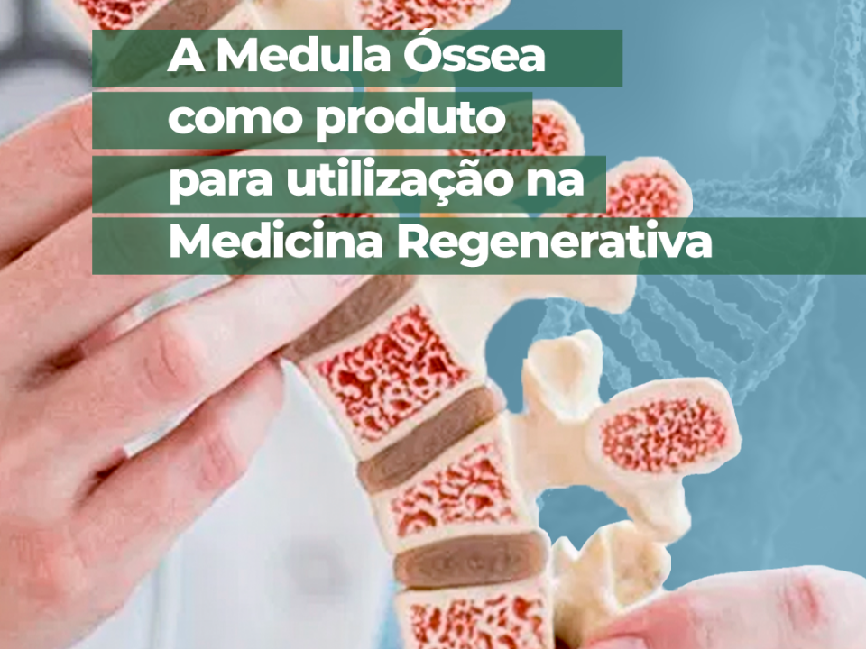 a-medula-ossea-como-produto-para-utilizacao-na-medicina-regenerativa