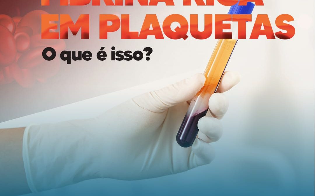 fibrina-rica-em-plaquetas-–-o-que-e-isso?