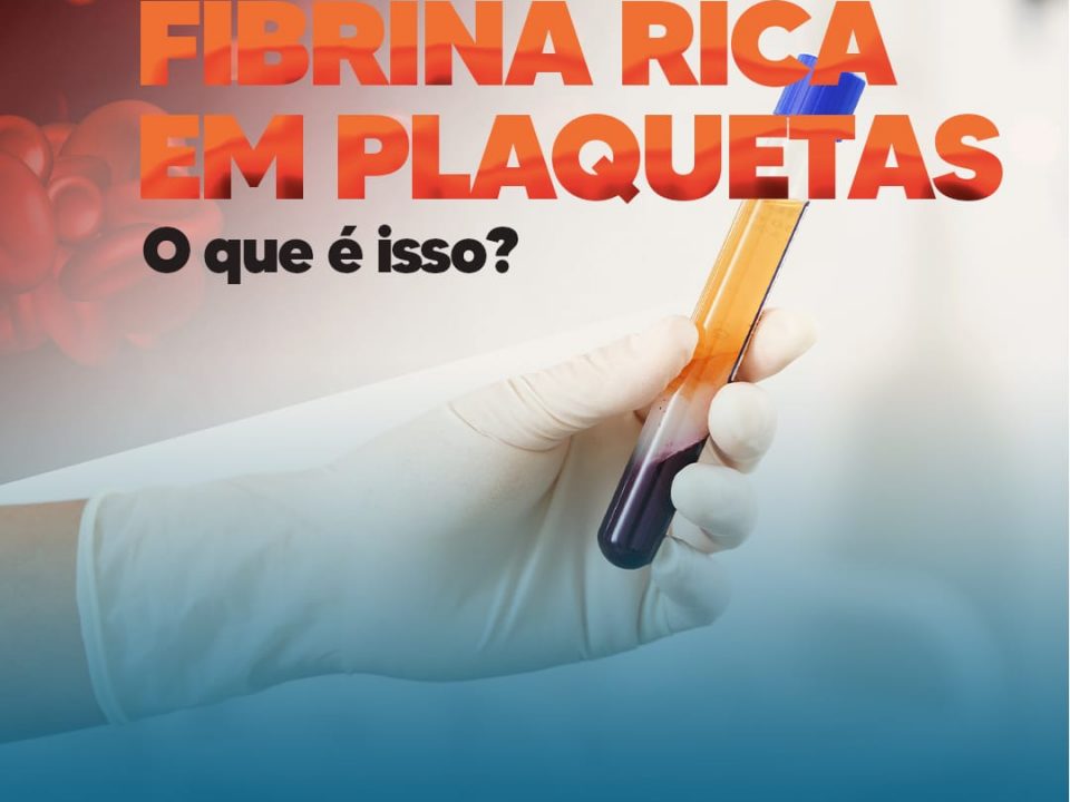 fibrina-rica-em-plaquetas-–-o-que-e-isso?